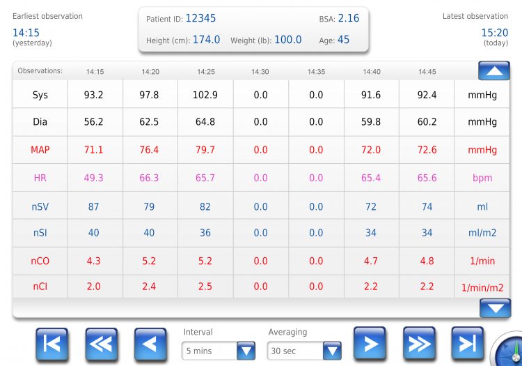 Hemodynamic Values Chart