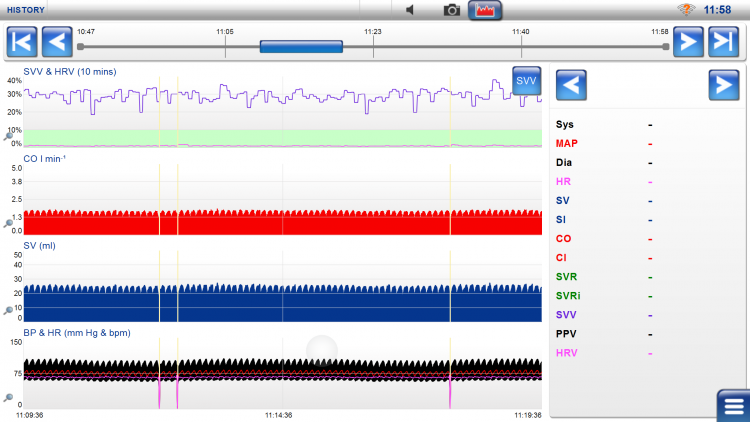 Normal Hemodynamic Values Chart