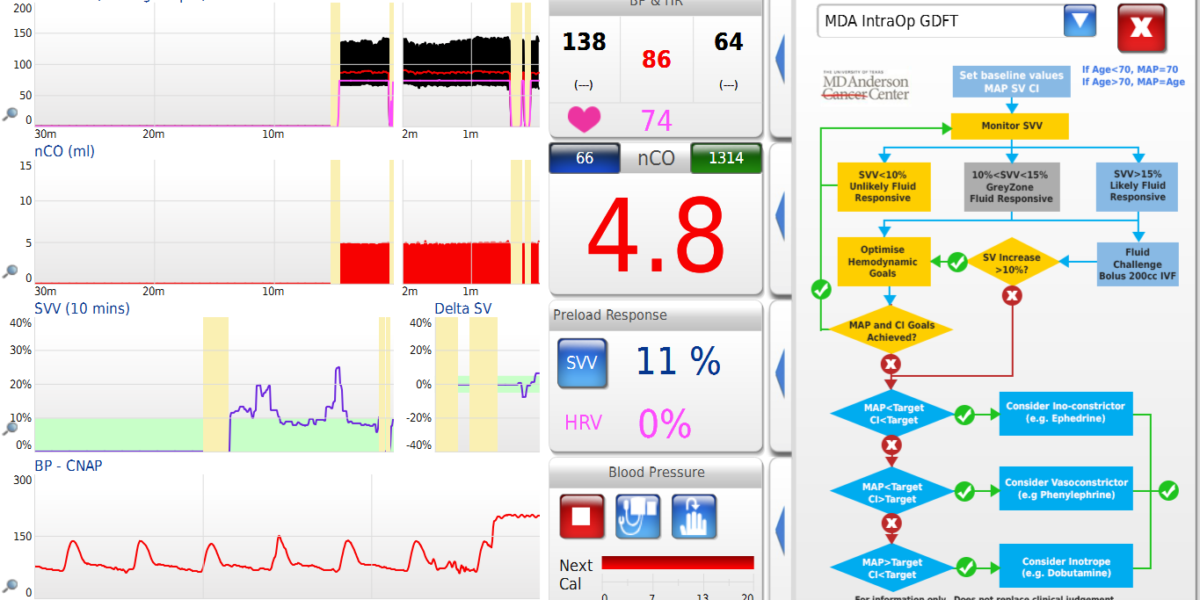 Hemodynamic Values Chart