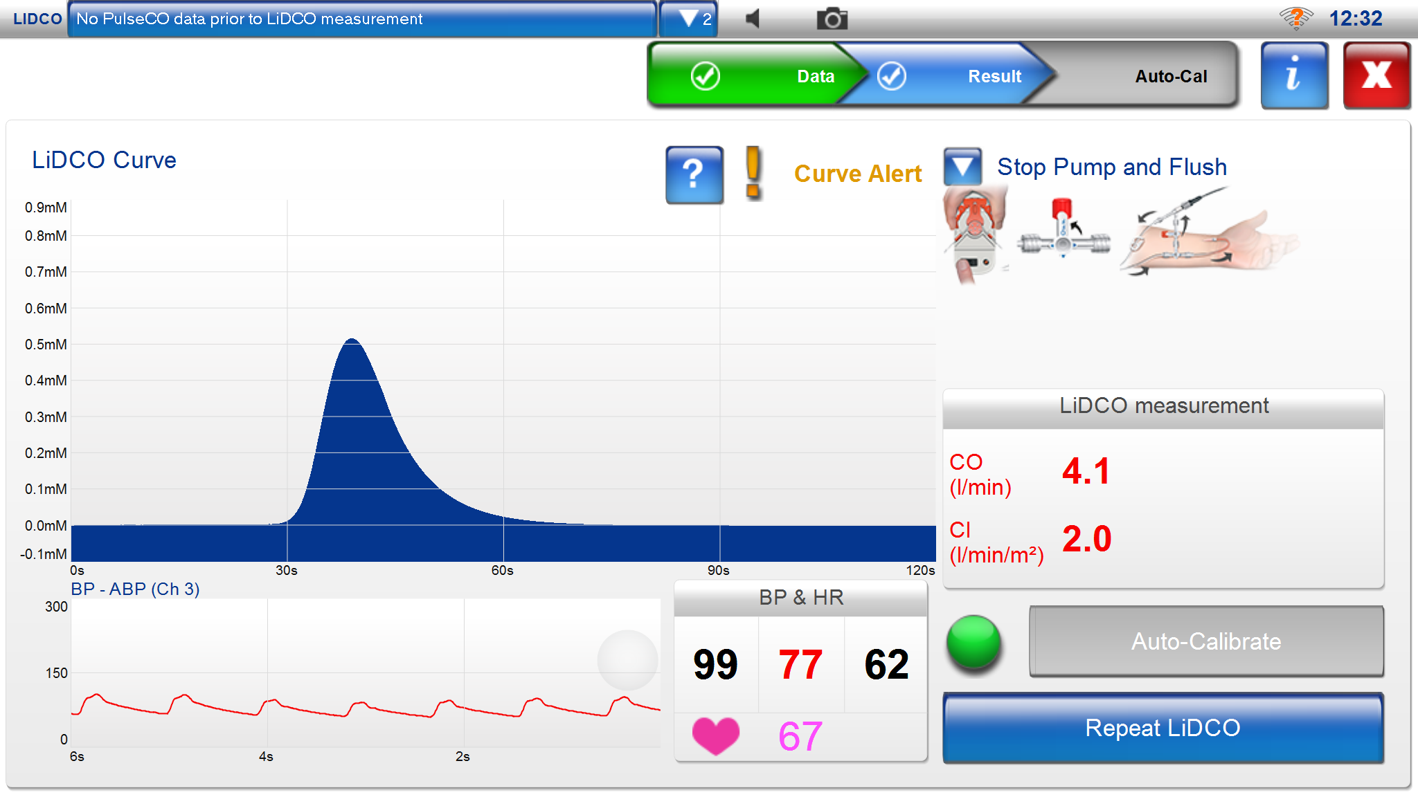 LiDCOplus | LiDCO – Hemodynamic Monitoring for the entire patient pathway